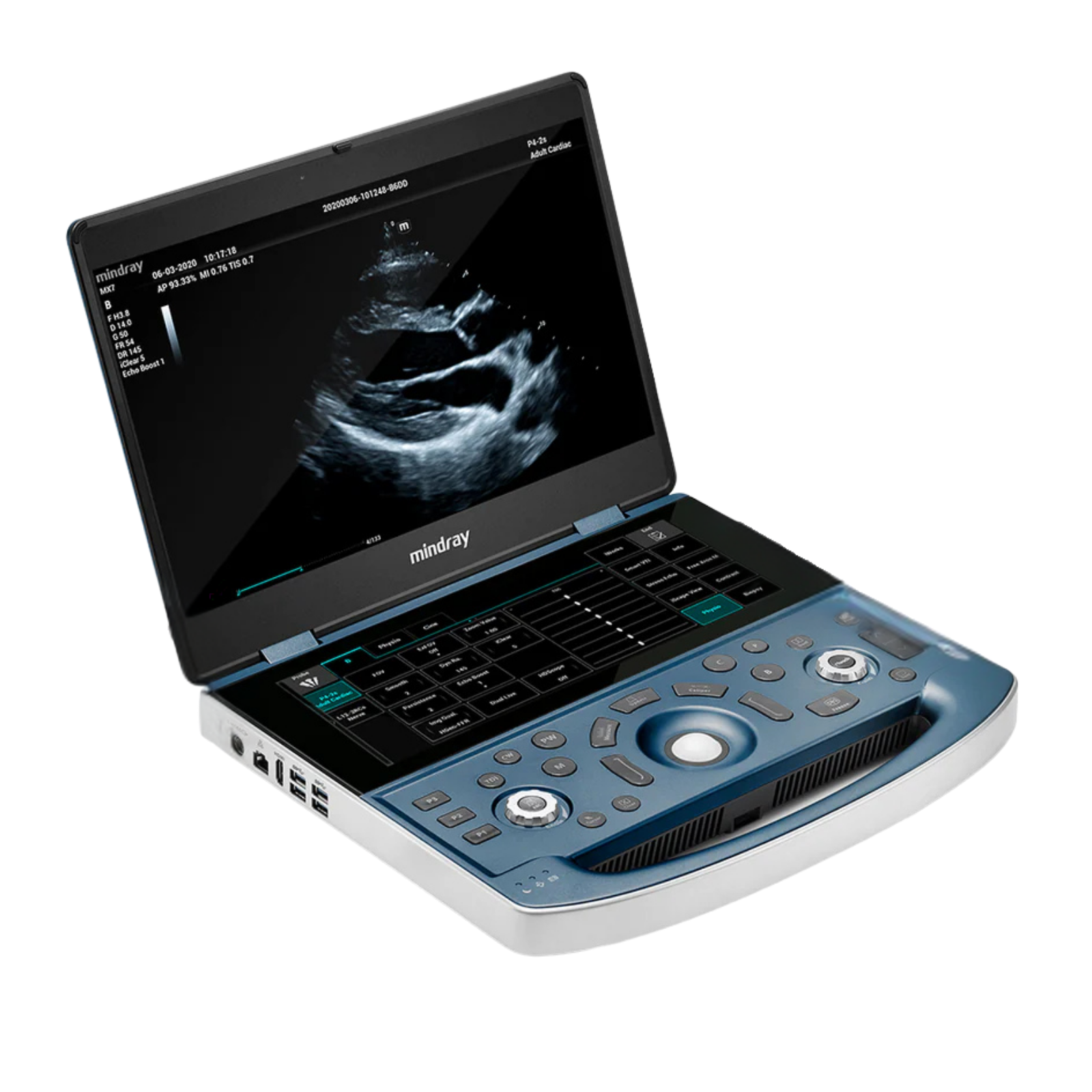 Mindray MX7